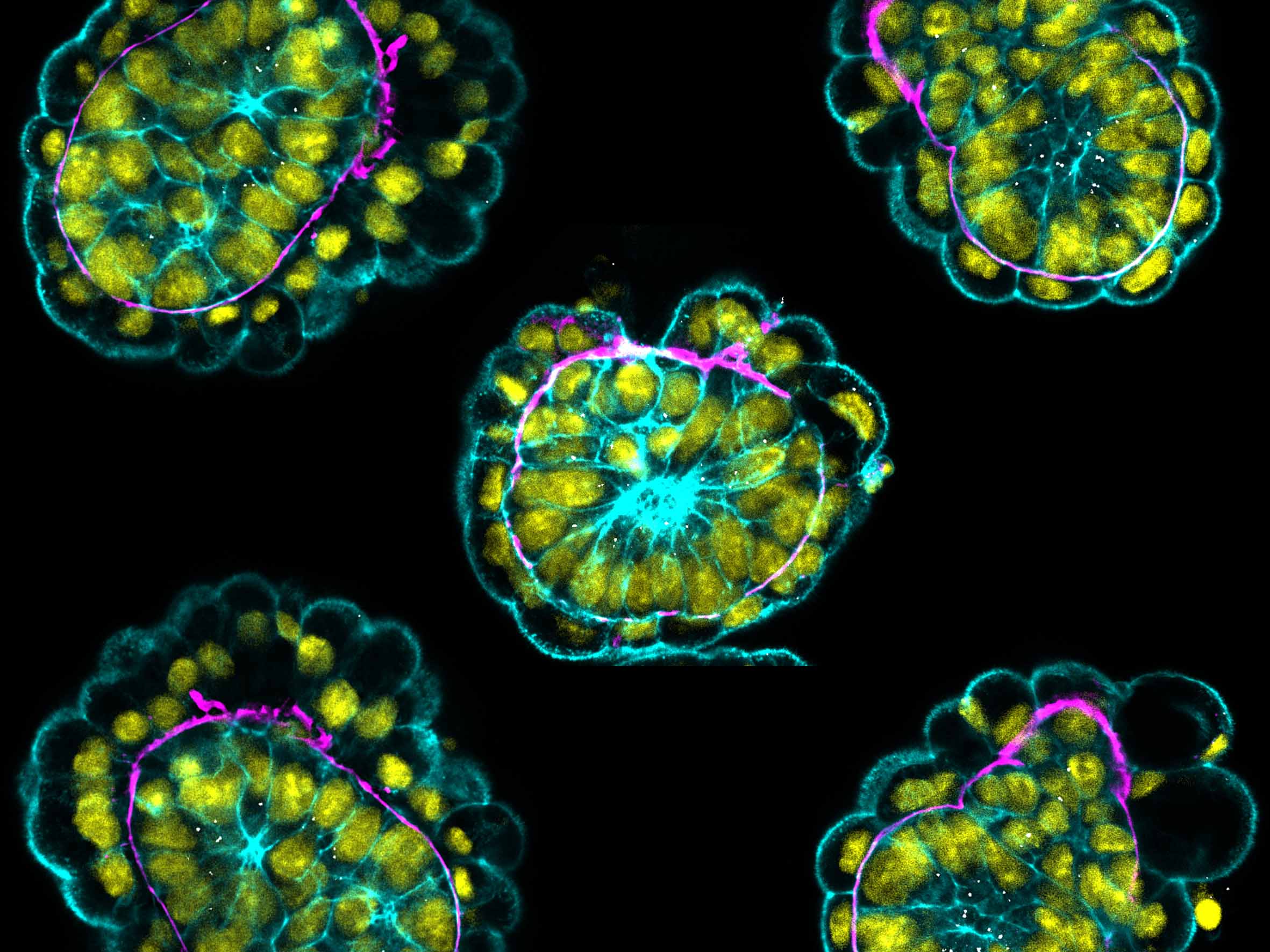Rosette stage embryo.  Boundaries between the cells in cyan, nuclei in yellow, basal membrane in pink - Magda Zernicka-Goetz
